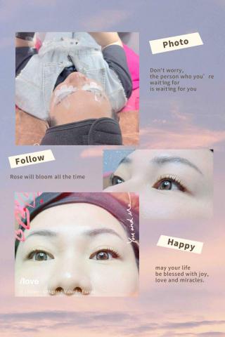 Ling Meng Li - 睫毛角蛋白