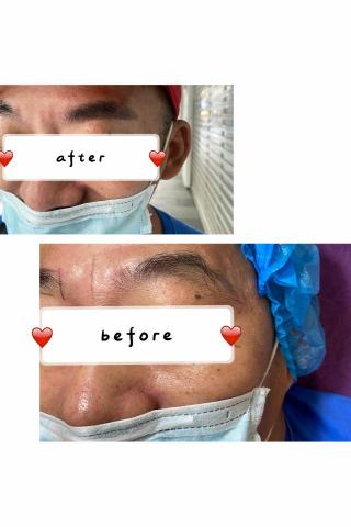 Relax Beauty studio - #霧眉_男士霧眉(沒有霧過眉)留色率95% Relax Beauty studio - #霧眉_男士霧眉(沒有霧過眉)留色率95%