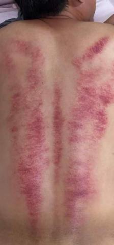 台北林老師到府按摩 -  台北林老師到府按摩 -