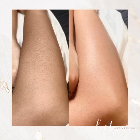 Artmiss_hotwax - 熱蠟除手毛