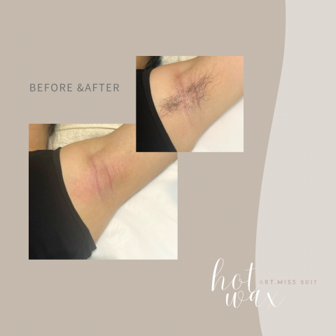 Artmiss_hotwax - 熱蠟除腋毛