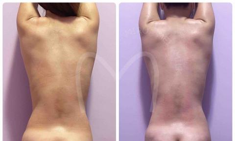 M.M.M泌乳美胸養護中心 - 體態雕塑課程