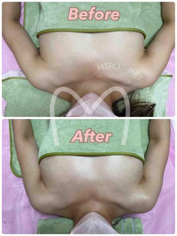 M.M.M泌乳美胸養護中心 - 美胸養護課程