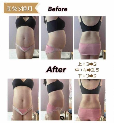 M.M.M泌乳美胸養護中心 - 腹直肌復位課程