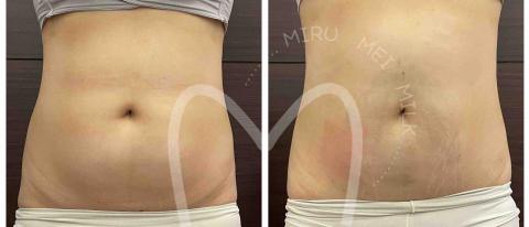 M.M.M泌乳美胸養護中心 - 婦活暖宮課程