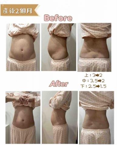 M.M.M泌乳美胸養護中心 - 腹直肌復位課程