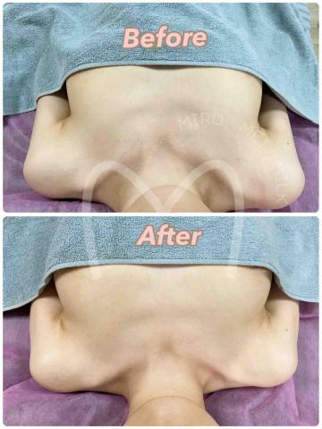 M.M.M泌乳美胸養護中心 -  美胸養護課程