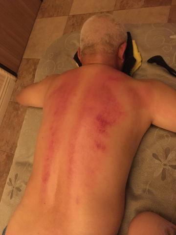 QQ工作室 - 純手技的推拿出痧，顧客放鬆後自然入睡，出痧的幾天建議多沖熱水澡並多喝溫開水幫助身體排酸排毒！