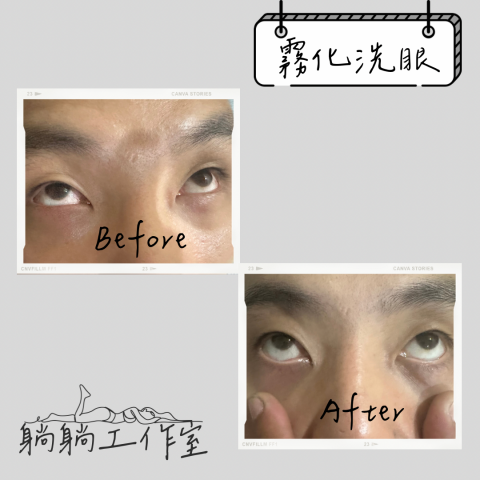 躺躺工作室 - 霧化洗眼對比