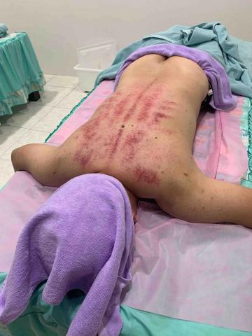 摩藝屋-傳統整復推拿｜骨盆回正訓練｜ - 精油按摩、刮痧調理