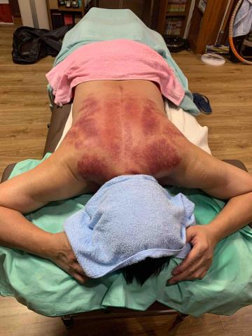 摩藝屋-傳統整復推拿｜骨盆回正訓練｜ - 到府精油按摩、經絡刮痧調理