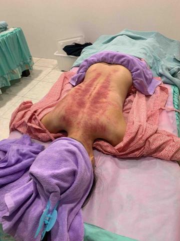 摩藝屋-傳統整復推拿｜骨盆回正訓練｜ - 油壓刮痧經絡調離