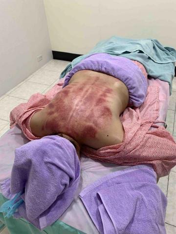 摩藝屋-傳統整復推拿｜骨盆回正訓練｜ - 刮痧經絡調理