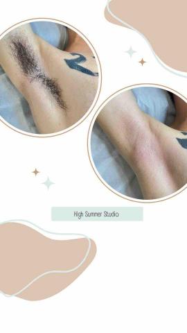 High Summer工作室 - 男士腋下除毛