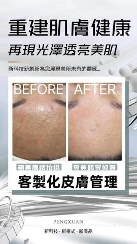 屏東韓式無痛清粉刺｜屏東艾草溫罐｜屏東筋膜刀按摩｜屏東美業空 - 客製化皮膚管理