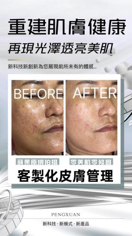 屏東韓式無痛清粉刺｜屏東艾草溫罐｜屏東筋膜刀按摩｜屏東美業空 - 客製化皮膚管理