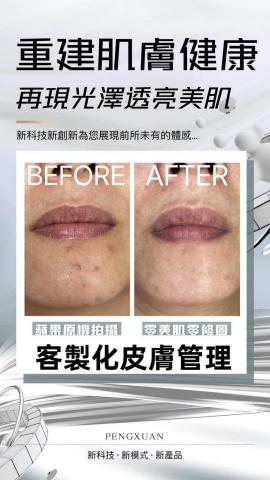 屏東韓式無痛清粉刺｜屏東艾草溫罐｜屏東筋膜刀按摩｜屏東美業空 - 客製化皮膚管理