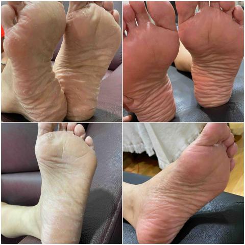 Yuci 健身教練 運動按摩 筋膜放鬆 - ⬅️保養前➡️保養後 Yuci 健身教練 運動按摩 筋膜放鬆 - ⬅️保養前➡️保養後