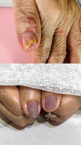 Yen_li_beauty - 指甲補救