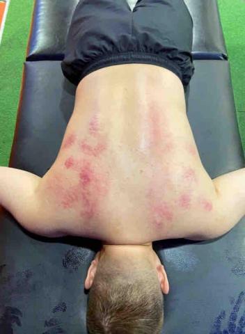 Yuci 健身教練 運動按摩 筋膜放鬆 -  Yuci 健身教練 運動按摩 筋膜放鬆 -