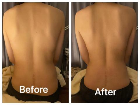 Linda - 手波經絡調理，腰部曲線都出來了，調理酸痛問題，幫助深層睡眠。