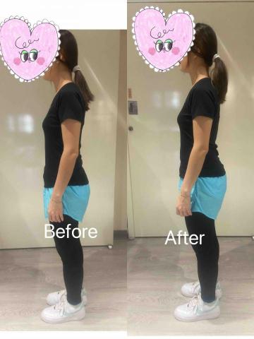 Lynn Chao🌼 皮拉提斯/核心訓練/體態管理🌼 - 原先脖子往前傾、調整完後有往正確位置改善