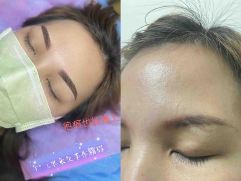 Ts手作霧眉 - 疤痕的眉也能夠完美