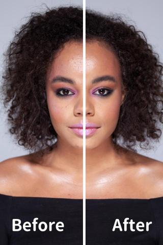 Yu Chen - 醫美廣告DM