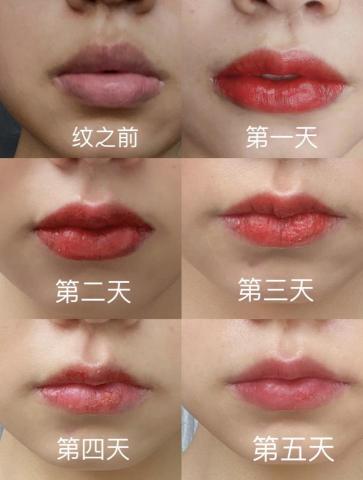 K.T半永久紋繡 - 唇部修復