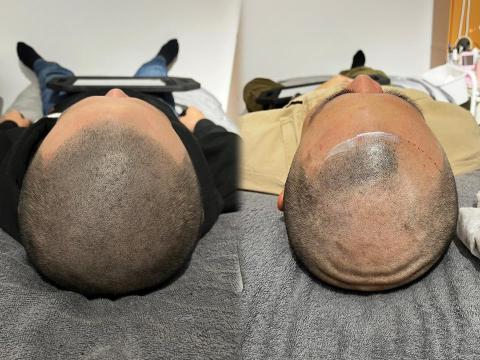 K.T半永久紋繡 - 9D仿毛讓紋髮