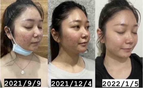 李舒洆 - 對比照