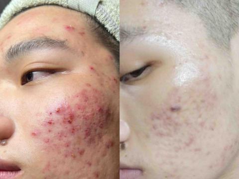 李舒洆 - 對比照