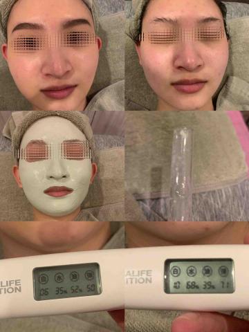 李舒洆 - 臉部保養