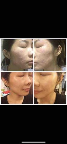 李舒洆 -  臉部對比照