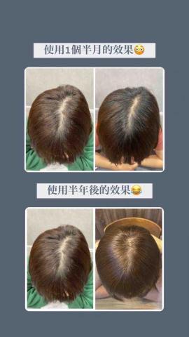 李舒洆 - 頭髮對比照