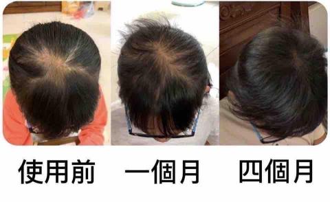 李舒洆 - 頭髮對比照