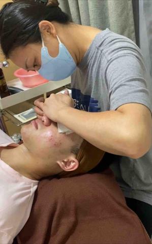葦莛專業美學 - 無痛清粉刺/痘痘 | 問題皮膚處理