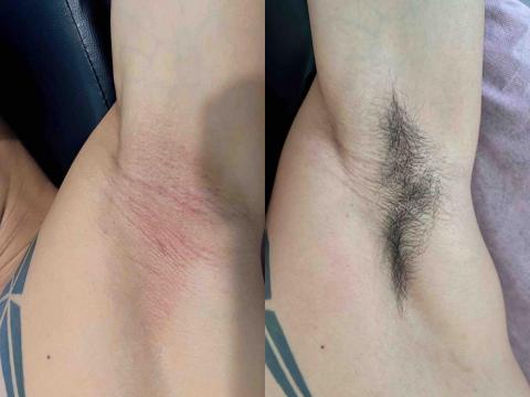 十六-按摩-龍筋 - 