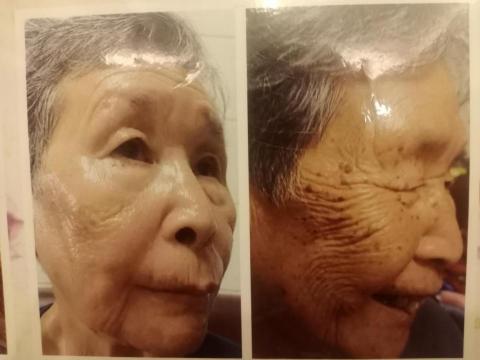 亮采美肌坊 - 活顏養膚使用前後