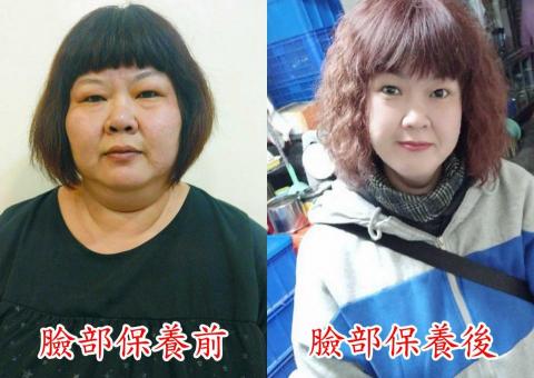 亮采美肌坊 - 臉部活顏養膚及減重管理前後