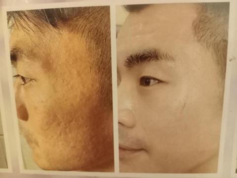 亮采美肌坊 - 活顏養膚，膚況改善