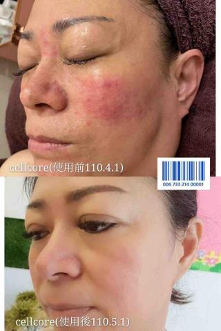 沛登美容美髮造型館 - 問題肌膚 沛登美容美髮造型館 - 問題肌膚