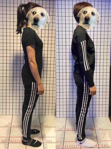 米拉按摩 - 改善骨盆前傾、腰酸問題