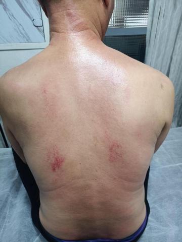 寡人有吉經絡按摩 - 筋膜刀放鬆