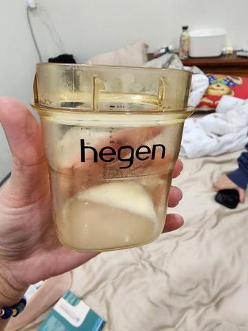國際無痛疏通手法蕎安泌乳師 - 量少的奶量還是有努力接到奶瓶裡喔！滴滴珍貴。