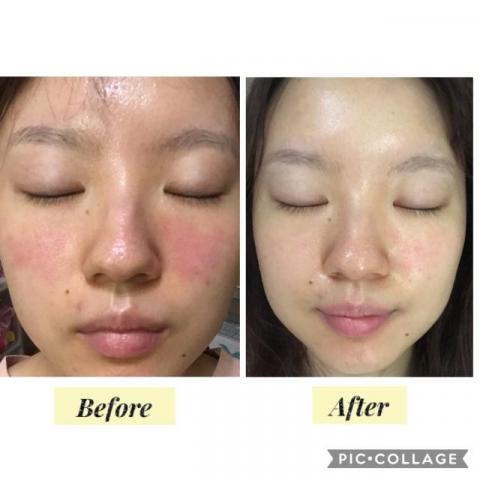 Berrice行動美容師-宜芳Lucia  - 幫助許多過敏肌的女孩們能正常的保養及愛漂亮