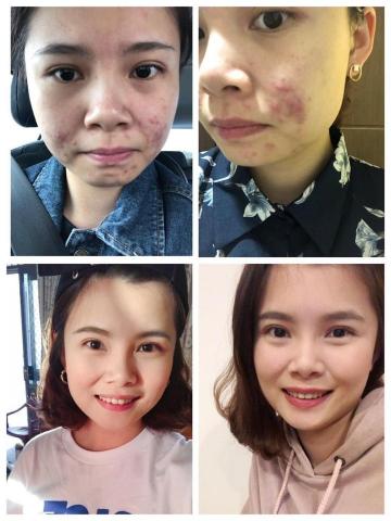 Berrice行動美容師-宜芳Lucia  - 皮膚變好都自信起來啦 ！