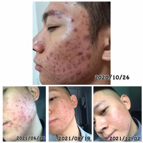 Berrice行動美容師-宜芳Lucia  - 男生也有變帥的權利 