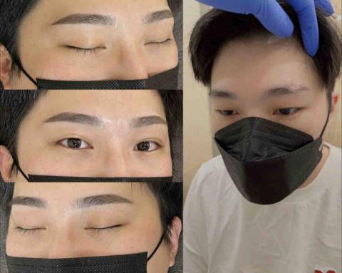 Andy - Andy霧眉 男士霧眉（原生眉毛有缺角）前後照