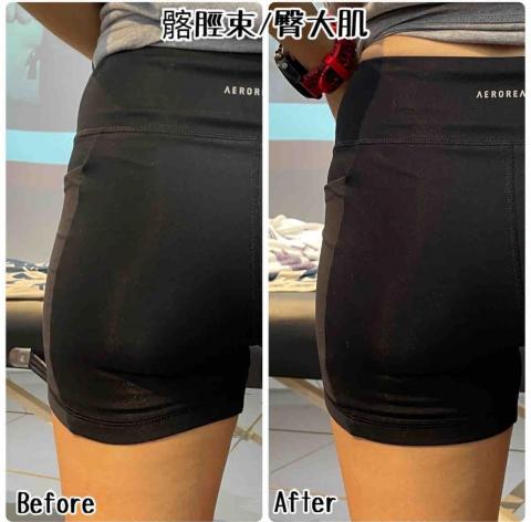 康殷杰Jacky - 矯正排列 修正臀型